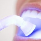Limpieza dental profesional