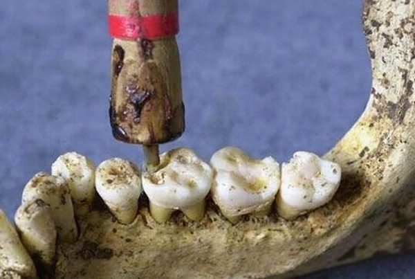 dentistas prehistóricos