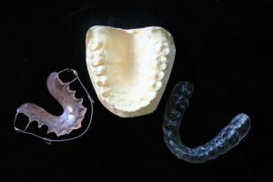 Brackets u Ortodoncia Invisible