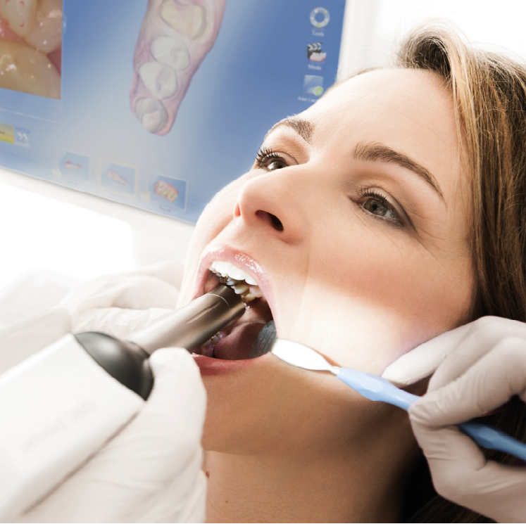 3D escáner CEREC Omnicam